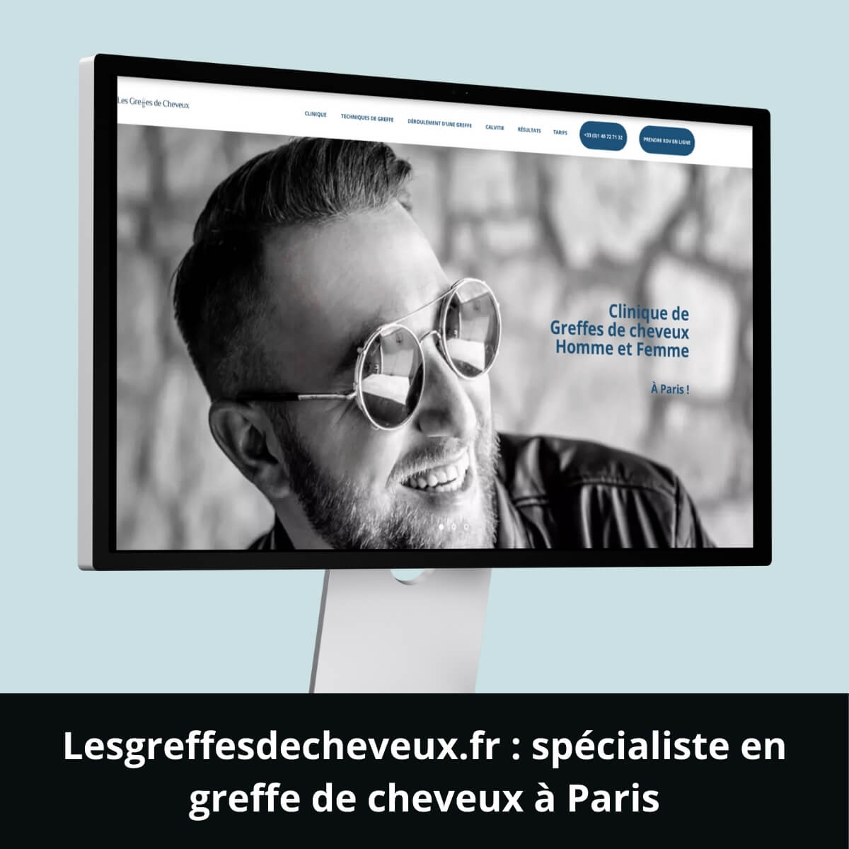 Lesgreffesdecheveux.fr&nbsp;: spécialiste en greffe de cheveux à Paris